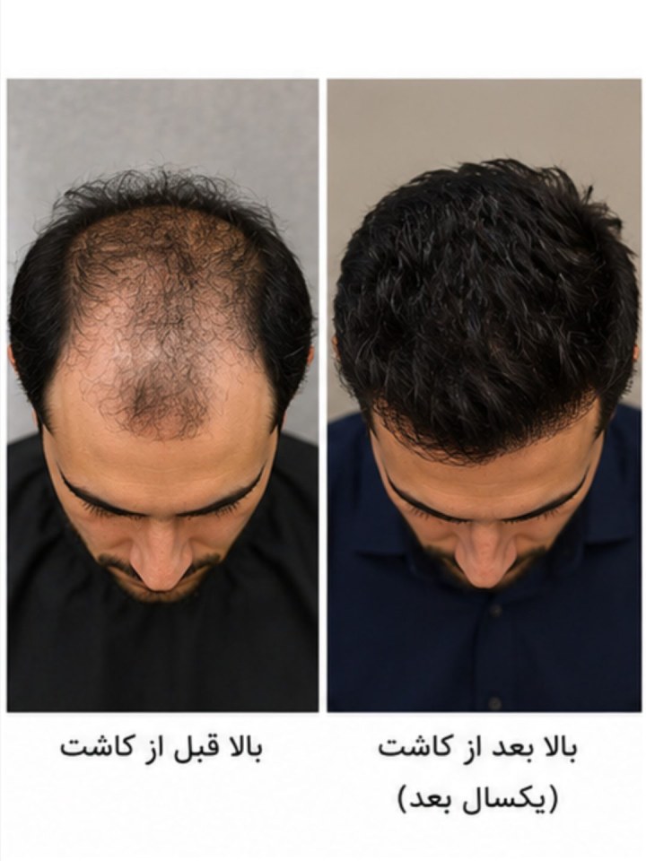 بعد