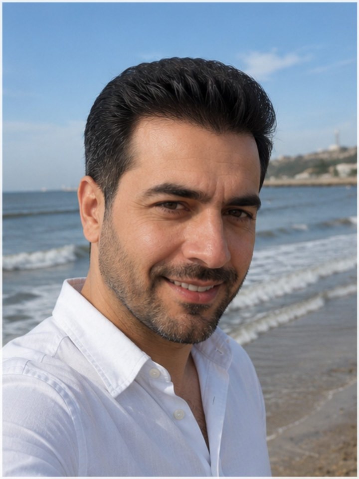 سه رخ . بعد - کاشت مو