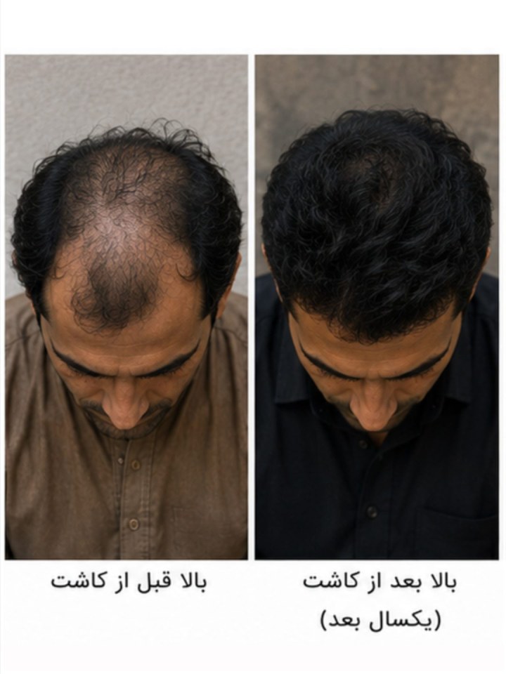 بعد