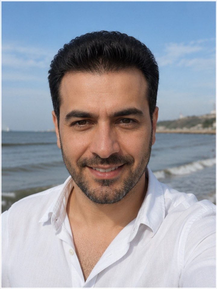 بعد - کاشت مو